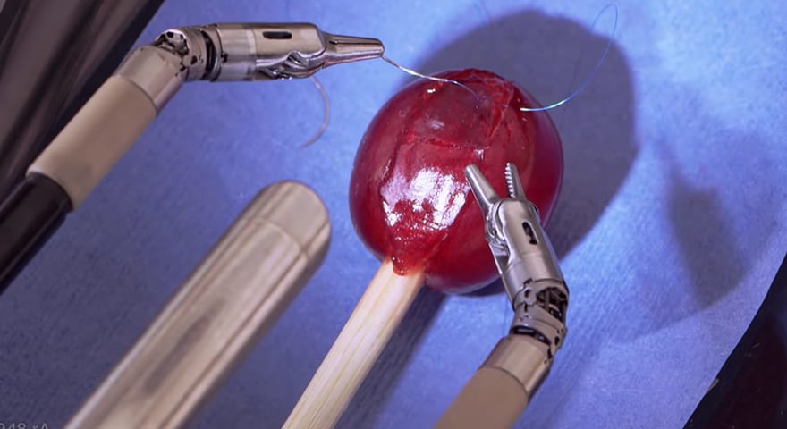 They Did Surgery On A Grape